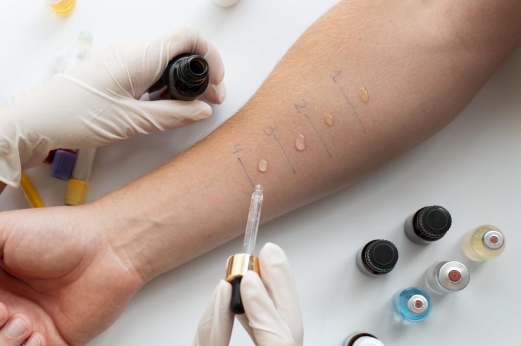 Allergy Test Singapore: How do you get Tested for Allergies?